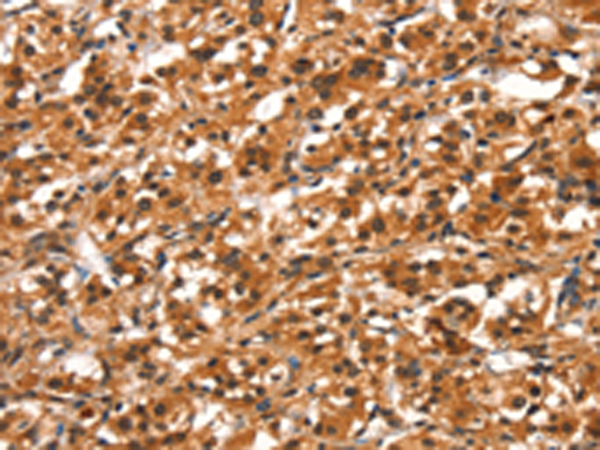 Rabbit Polyclonal Antibody to DDX4