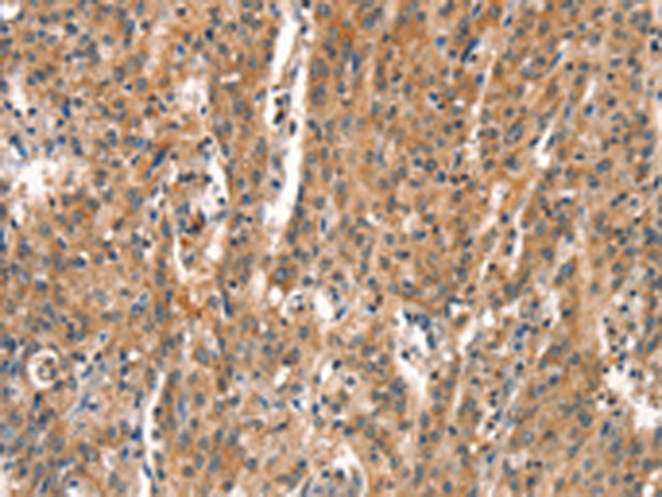 Rabbit Polyclonal Antibody to DEAF1