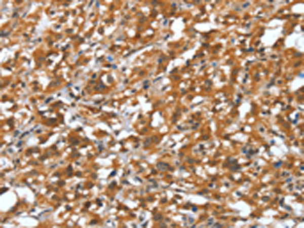 Rabbit Polyclonal Antibody to DEFA4