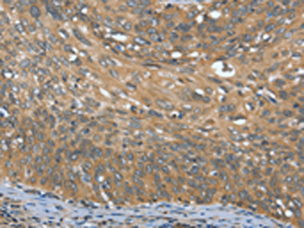 Rabbit Polyclonal Antibody to OPRD1