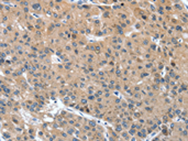 Rabbit Polyclonal Antibody to DSC1
