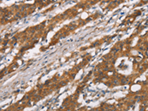 Rabbit Polyclonal Antibody to DSC2