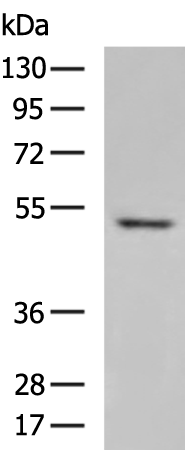 Rabbit Polyclonal Antibody to DGAT1