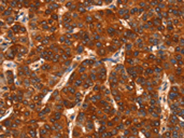 Rabbit Polyclonal Antibody to DHH