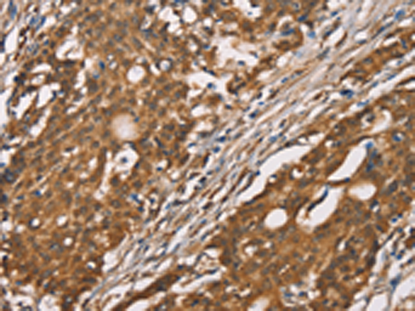 Rabbit Polyclonal Antibody to DICER1