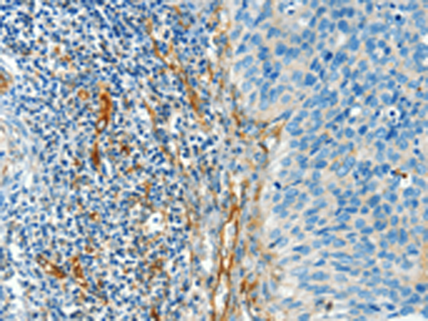 Rabbit Polyclonal Antibody to DIO2