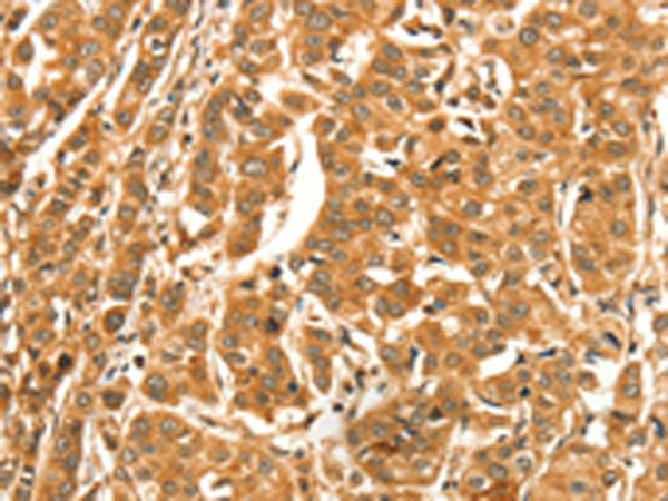 Rabbit Polyclonal Antibody to DIRAS1