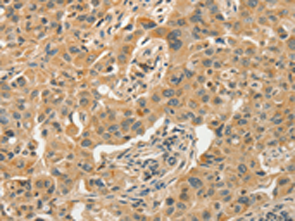 Rabbit Polyclonal Antibody to SLC11A2