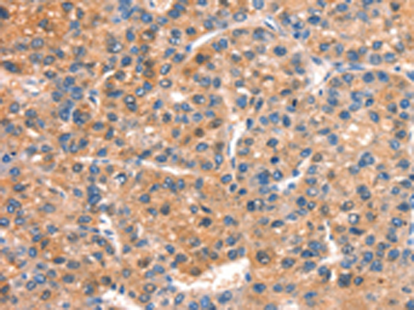 Rabbit Polyclonal Antibody to DOCK1