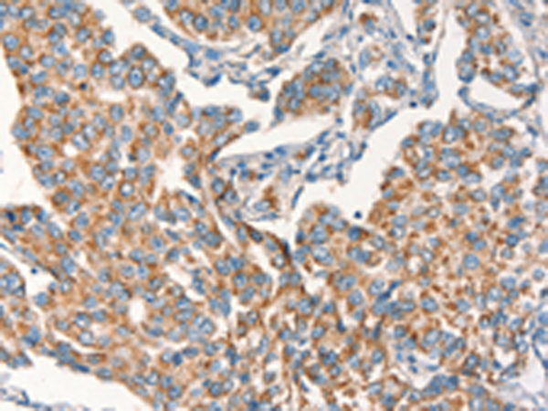 Rabbit Polyclonal Antibody to DSP