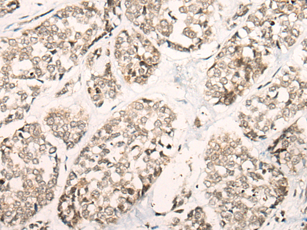 Rabbit Polyclonal Antibody to POLA1