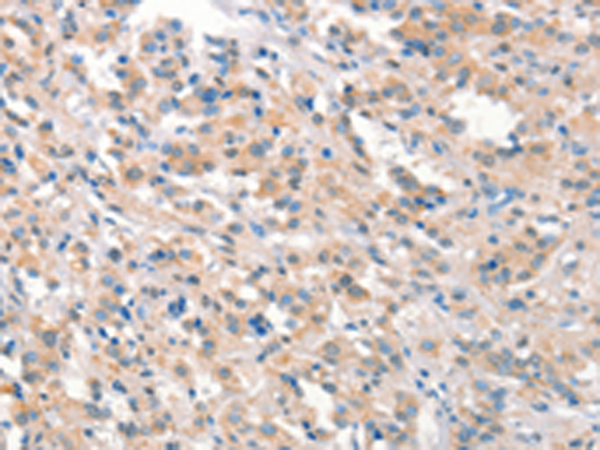 Rabbit Polyclonal Antibody to KCNB1