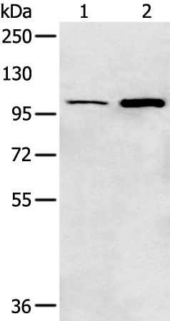 Rabbit Polyclonal Antibody to KCNB1