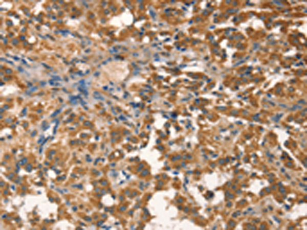 Rabbit Polyclonal Antibody to AGO1