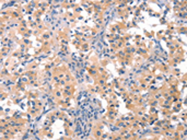 Rabbit Polyclonal Antibody to EIF4G1