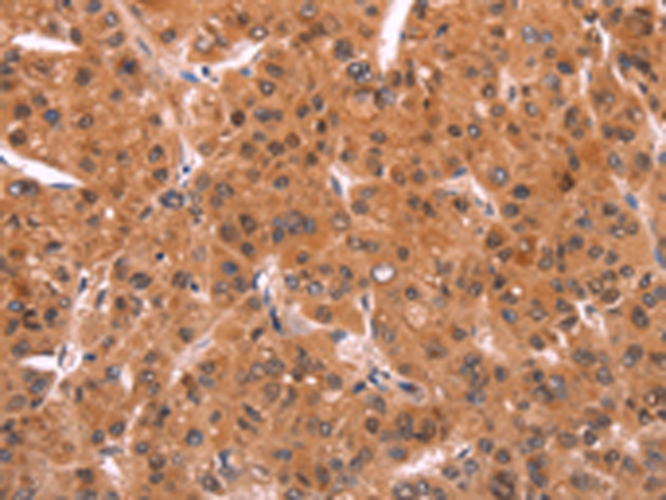 Rabbit Polyclonal Antibody to EMP2