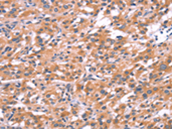 Rabbit Polyclonal Antibody to ENDOG