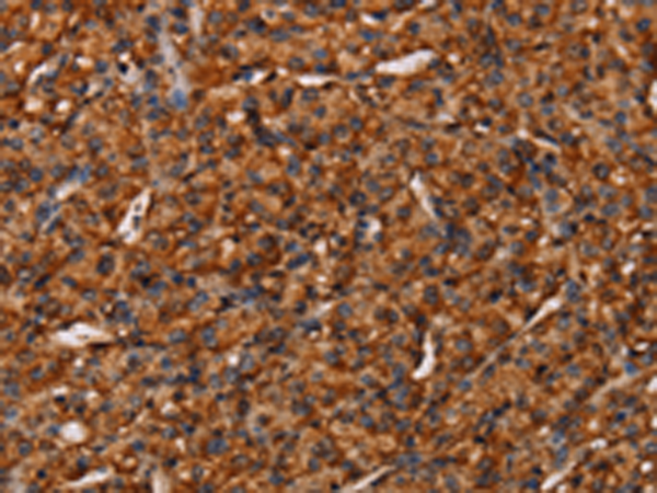 Rabbit Polyclonal Antibody to COL18A1