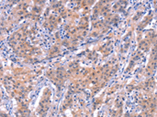 Rabbit Polyclonal Antibody to EP300