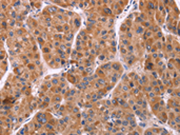 Rabbit Polyclonal Antibody to EFNA5