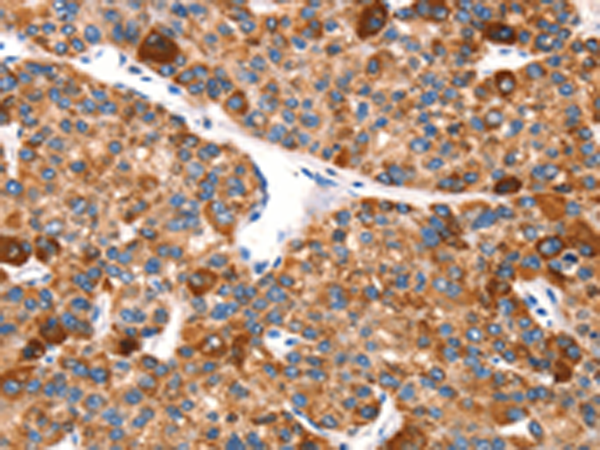 Rabbit Polyclonal Antibody to EPO