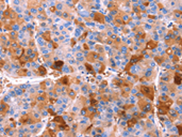 Rabbit Polyclonal Antibody to ERN2