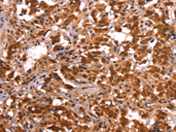 Rabbit Polyclonal Antibody to ESRRB