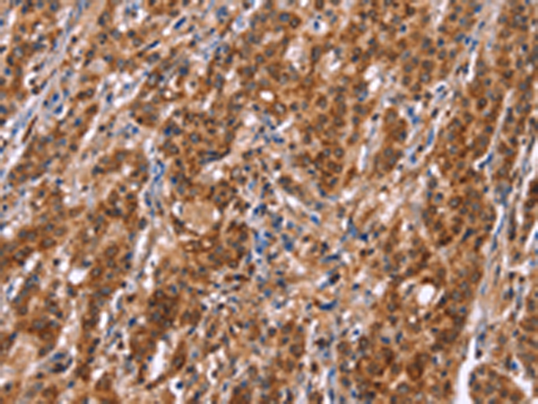 Rabbit Polyclonal Antibody to TDP2