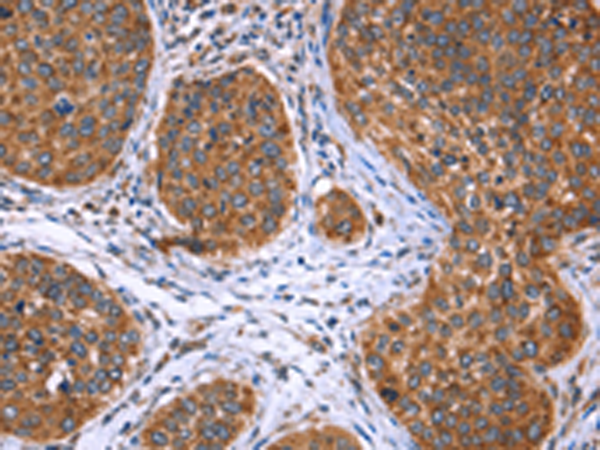 Rabbit Polyclonal Antibody to EVC2