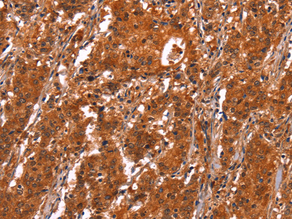 Rabbit Polyclonal Antibody to GCG(Glicentin)