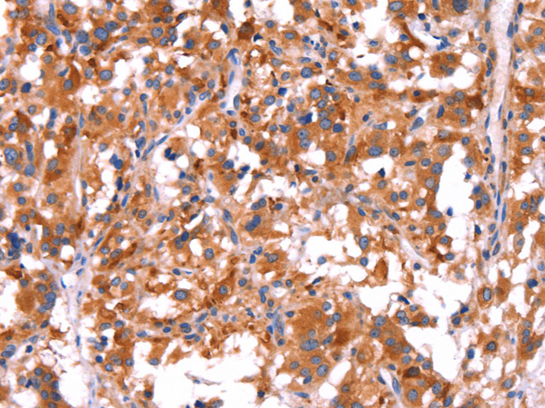 Rabbit Polyclonal Antibody to GCG(GLP1)