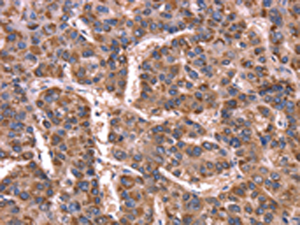 Rabbit Polyclonal Antibody to GCG(GLP2)