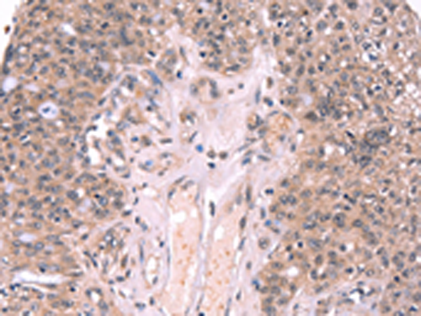 Rabbit Polyclonal Antibody to EXTL1