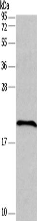Rabbit Polyclonal Antibody to FAIM