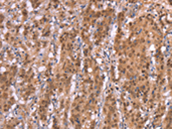 Rabbit Polyclonal Antibody to AMER1