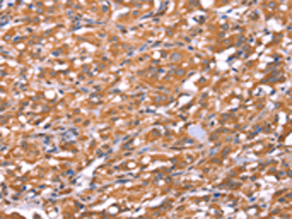 Rabbit Polyclonal Antibody to FAM13B