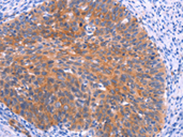 Rabbit Polyclonal Antibody to PTPN13