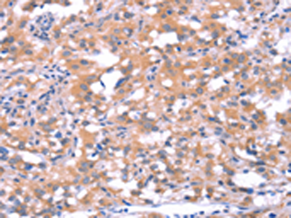 Rabbit Polyclonal Antibody to FAT1