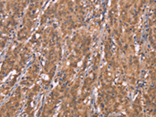Rabbit Polyclonal Antibody to FBXO31
