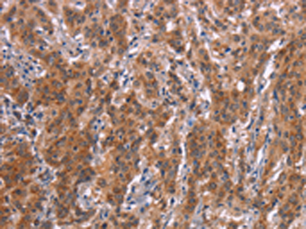 Rabbit Polyclonal Antibody to FDCSP