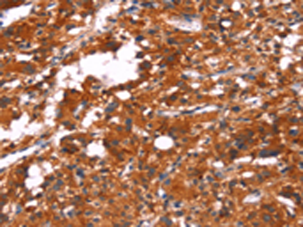 Rabbit Polyclonal Antibody to FEM1A