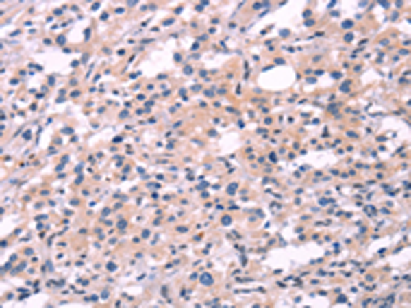 Rabbit Polyclonal Antibody to FGF16