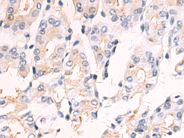 Rabbit Polyclonal Antibody to FGF20