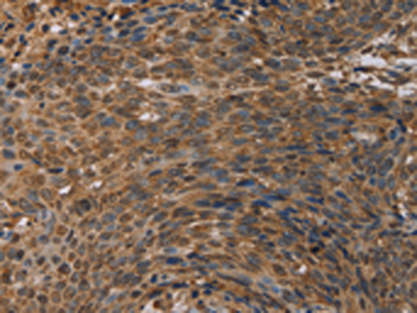 Rabbit Polyclonal Antibody to HIF1AN