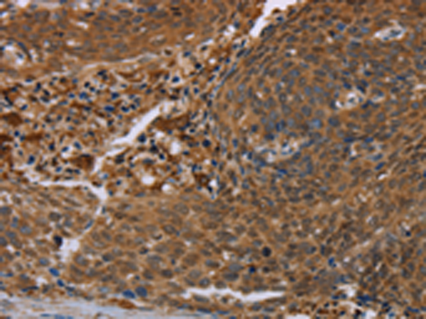 Rabbit Polyclonal Antibody to FLG