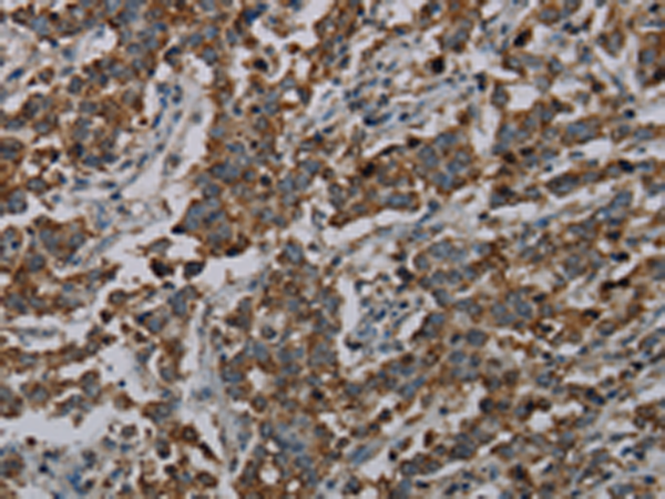 Rabbit Polyclonal Antibody to CFLAR