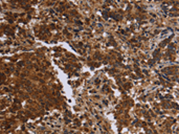 Rabbit Polyclonal Antibody to FMN2