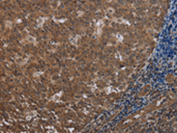 Rabbit Polyclonal Antibody to FOLH1B