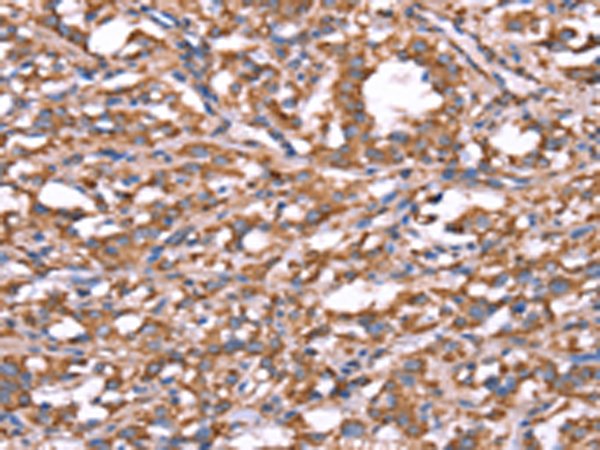 Rabbit Polyclonal Antibody to SPAST
