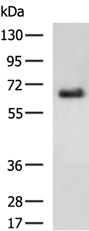Rabbit Polyclonal Antibody to FUT8
